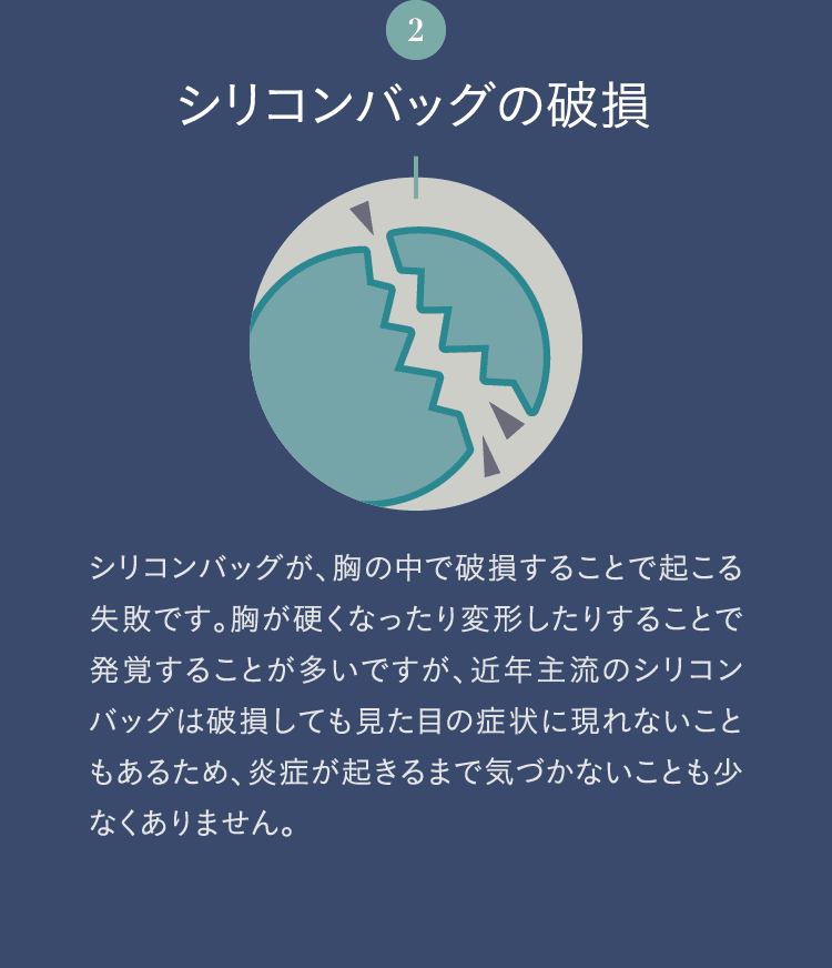 2. シリコンバッグの破損 | シリコンバッグが、胸の中で破損することで起こる失敗です。胸が硬くなったり変形したりすることで発覚することが多いですが、近年主流のシリコンバッグは破損しても見た目の症状に現れないこともあるため、炎症が起きるまで気づかないことも少なくありません。