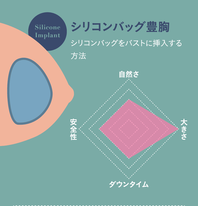 シリコンバッグ豊胸(シリコンバッグをバストに挿入する方法)