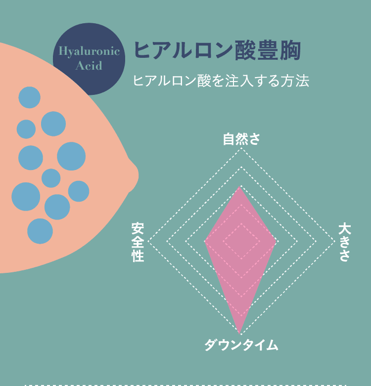 ヒアルロン酸豊胸（ヒアルロン酸を注入する方法）