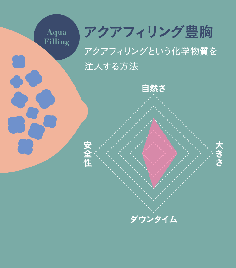 アクアフィリング豊胸（アクアフィリングという化学物質を注入する方法）