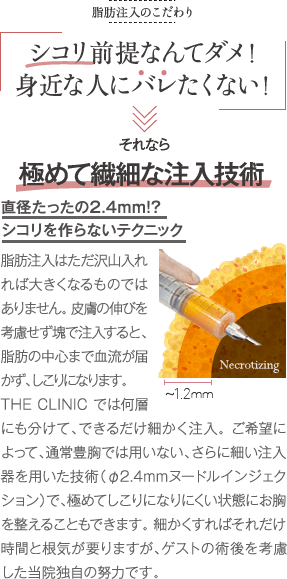 脂肪注入のこだわり | シコリ前提なんてダメ！ 身近な人にバレたくない！ | それなら 極めて繊細な注入技術 直径たったの2.4mm！？ シコリを作らないテクニック | 脂肪注入はただ沢山入れれば大きくなるものではありません。 皮膚の伸びを考慮せず塊で注入すると、脂肪の中心まで血流が届かず、しこりになります。THE CLINIC では何層にも分けて、できるだけ細かく注入。 ご希望によって、通常豊胸では用いない、さらに細い注入器を用いた技術（φ2.4mmヌードルインジェクション）で、極めてしこりになりにくい状態にお胸を整えることもできます。 細かくすればそれだけ時間と根気が要りますが、ゲストの術後を考慮した当院独自の努力です。