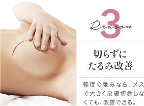 Reason 3 切らずにたるみ改善