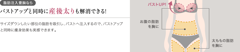 脂肪注入豊胸ならバストアップと同時に部分痩せも叶う!サイズダウンしたい部位の脂肪を吸引し、バストへ注入するので、バストアップと同時に痩身効果も実感できます。/お腹の脂肪を胸に/太ももの脂肪を胸に
