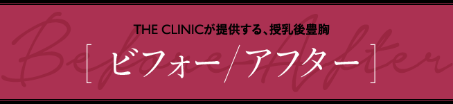 THE CLINICが提供する、授乳後豊胸 [ ビフォー/アフター ]