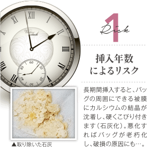 Risk 1 挿入年数によるリスク