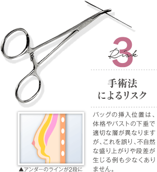 Risk 3 手術法によるリスク