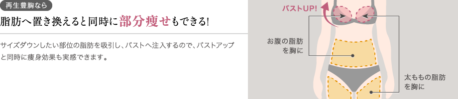 脂肪注入豊胸ならバストアップと同時に部分痩せも叶う!サイズダウンしたい部位の脂肪を吸引し、バストへ注入するので、バストアップと同時に痩身効果も実感できます。/お腹の脂肪を胸に/太ももの脂肪を胸に