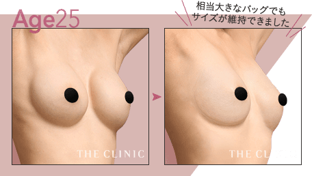 Age.25 相当大きなバッグでもサイズが維持できました