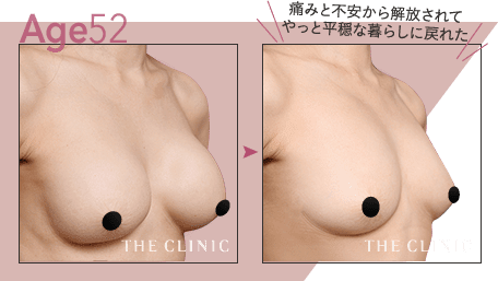Age.52 痛みと不安から解放されてやっと平穏な暮らしに戻れた