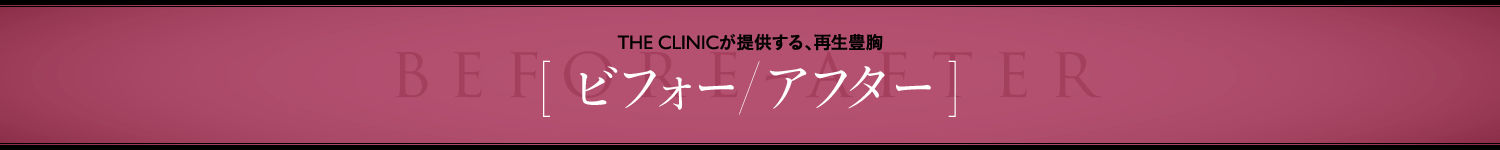 THE CLINICが提供する、再生豊胸 [ ビフォー/アフター ]