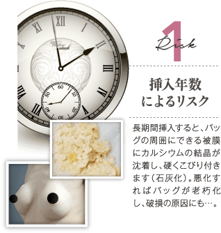 Risk 1 挿入年数によるリスク