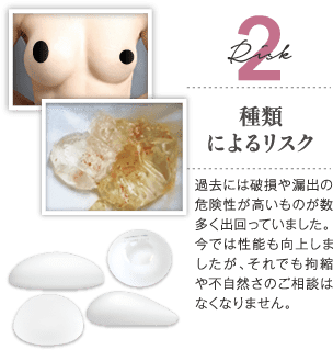 Risk 2 種類によるリスク