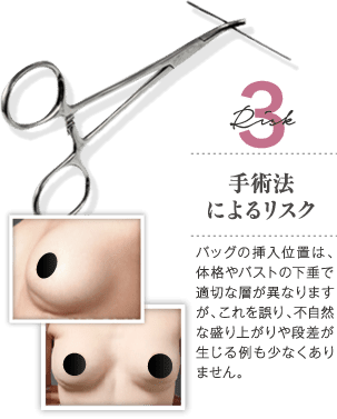Risk 3 手術法によるリスク