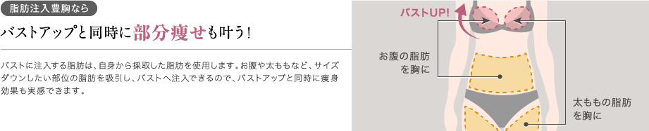 脂肪注入豊胸ならバストアップと同時に部分痩せも叶う!サイズダウンしたい部位の脂肪を吸引し、バストへ注入するので、バストアップと同時に痩身効果も実感できます。/お腹の脂肪を胸に/太ももの脂肪を胸に