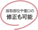 採取部位や傷口の修正も可能