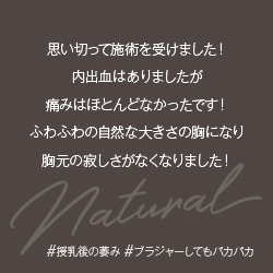 豊胸