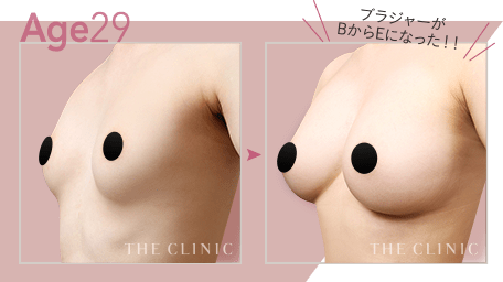 Age29 ブラジャーがBからEになった!!