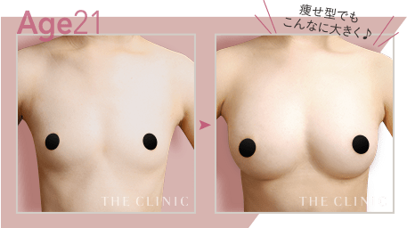 Age21 痩せ型でもこんなに大きく♪