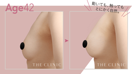 Age42 動いても、触ってもとにかく自然
