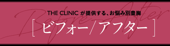 THE CLINICが提供する、お悩み別豊胸 [ ビフォー/アフター ]