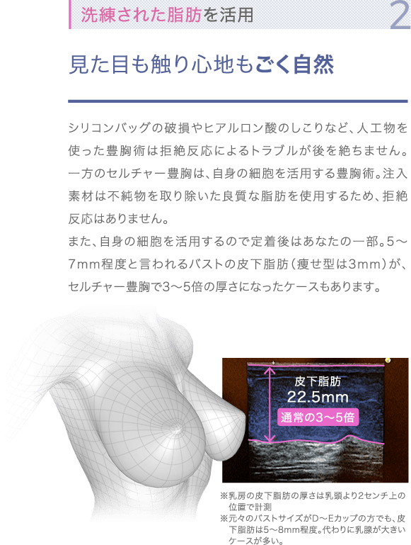 特徴2 洗練された脂肪を活用 | 見た目も触り心地もごく自然 | シリコンバッグの破損やヒアルロン酸のしこりなど、人工物を使った豊胸術は拒絶反応によるトラブルが後を絶ちません。一方のセルチャー豊胸は、自身の細胞を活用する豊胸術。注入素材は不純物を取り除いた良質な脂肪を使用するため、拒絶反応はありません。また、自身の細胞を活用するので定着後はあなたの一部。5〜7mm程度と言われるバストの皮下脂肪（痩せ型は3mm）が、セルチャー豊胸で3〜5倍の厚さになったケースもあります。