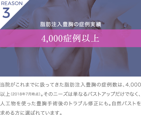 理由3 脂肪注入豊胸の症例実績 4,000症例以上 | 当院がこれまでに扱ってきた脂肪注入豊胸の症例数は、4,000以上（2018年7月時点）。そのニーズは単なるバストアップだけでなく、人工物を使った豊胸手術後のトラブル修正にも。自然バストを求める方に選ばれています。