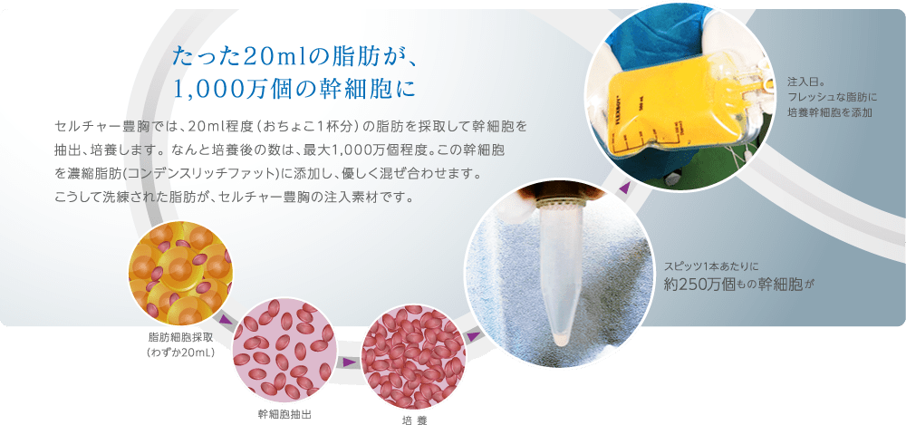 たった20mlの脂肪が、1,000万個の幹細胞に | セルチャー豊胸では、20ml程度（おちょこ１杯分）の脂肪を採取して幹細胞を抽出、培養します。なんと培養後の数は、最大1,000万個程度。この関西墓王を濃縮脂肪（コンデンスリッチファット）に添加し、優しく混ぜ合わせます。こうして洗練された脂肪が、セルチャー豊胸の注入素材です。