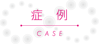 症例
