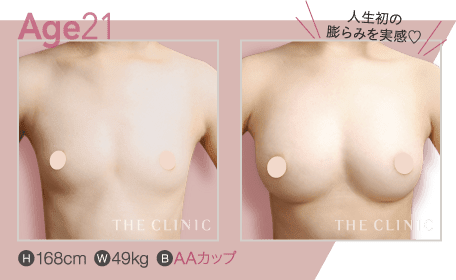 Age.21 | H: 168cm / W: 49kg / B: AAカップ