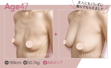 Age.47 | H: 169cm / W: 50.7kg / B: AAカップ
