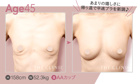 Age.45 | H: 158cm / W: 52.3kg / B: AAカップ
