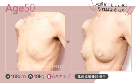 Age.50 | H: 168cm / W: 49kg / B: AAカップ ／ BRAVA併用