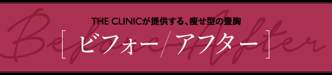 THE CLINICが提供する、痩せ型の豊胸 [ ビフォー/アフター ]