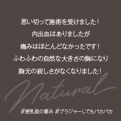 豊胸