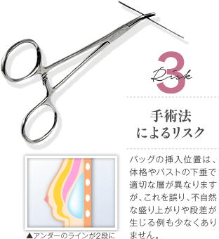 Risk 3 手術法によるリスク / バッグの挿入位置は、体格やバストの下垂で適切な層が異なりますが、これを誤り、不自然な盛り上がりや段差が生じる例も少なくありません。